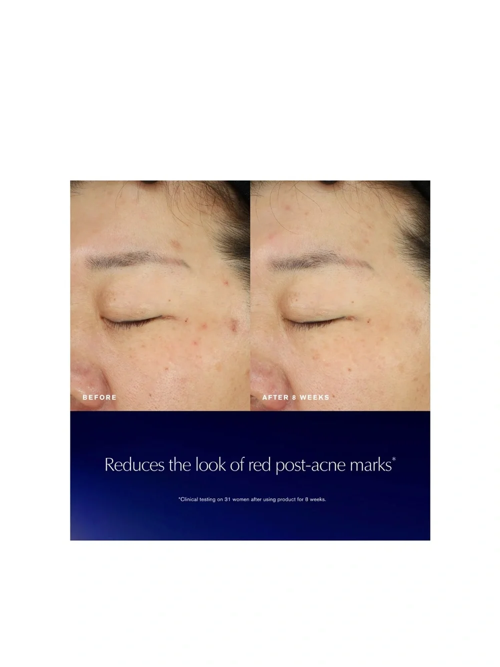 Estee Lauder bio exosome